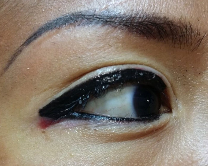 Permanent Cosmetics Eyeliner - Before & After Photos