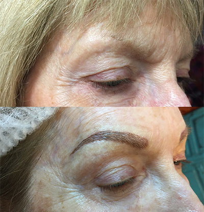 Eyebrow Microblading - Top Rated Certified Permanent Cosmetic Artist